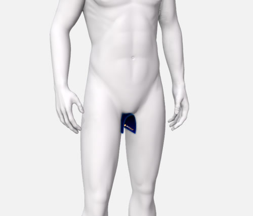 Prostata